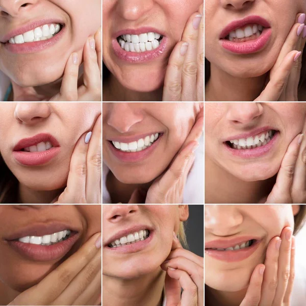 Dolor Caries Dental Boca Adolorida Dental Ache Collage — Foto de Stock