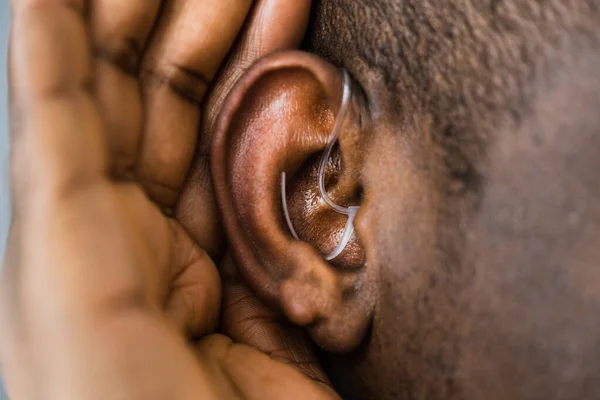 Aparelho Auditivo Audiologia Ajuda Para Deficientes Deficientes — Fotografia de Stock