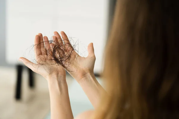 Νεαρή Γυναίκα Κρατώντας Απώλεια Μαλλιών Στα Χέρια — Φωτογραφία Αρχείου
