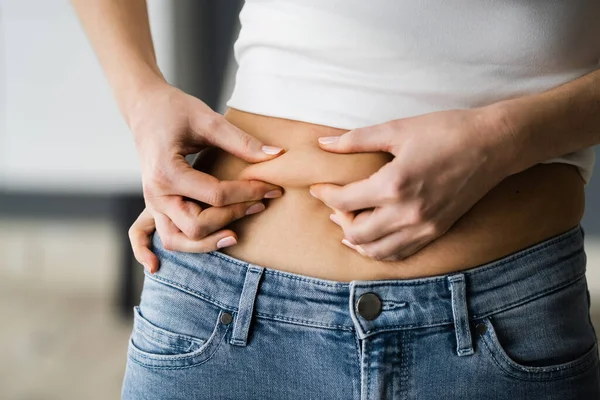 胃脂肪吸引と食事療法 胃の皮膚のピンチ — ストック写真