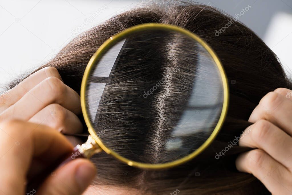 Woman Hairfall And Itching Examining By Doctor