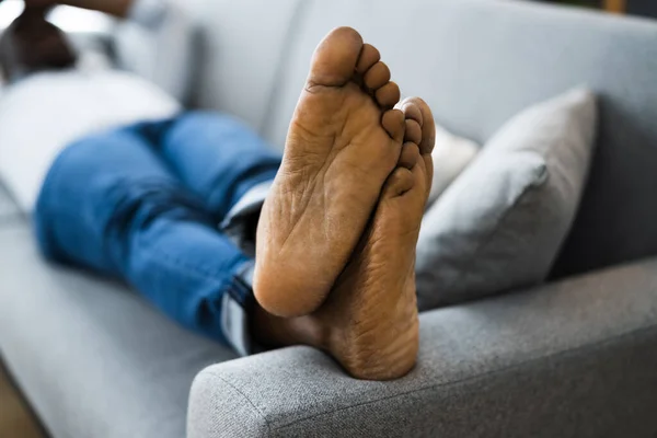 Barefoot African American Man Stinky Barefoot Legs — Stock Photo, Image