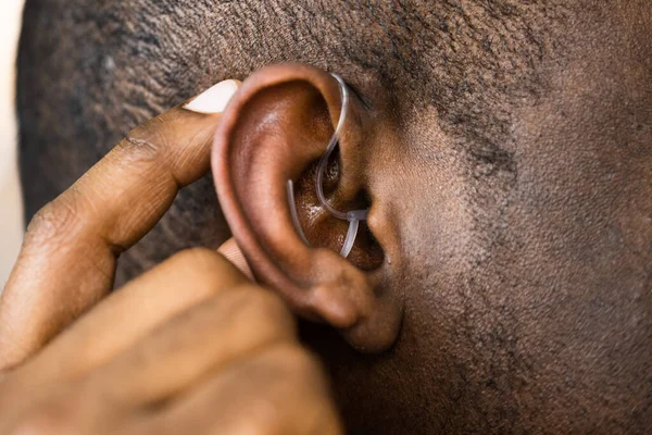 Aparelho Auditivo Audiologia Ajuda Para Deficientes Deficientes — Fotografia de Stock