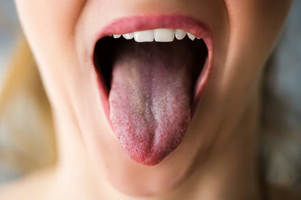 Healthy Woman Mouth Clean Tongue Out — Stock Photo, Image