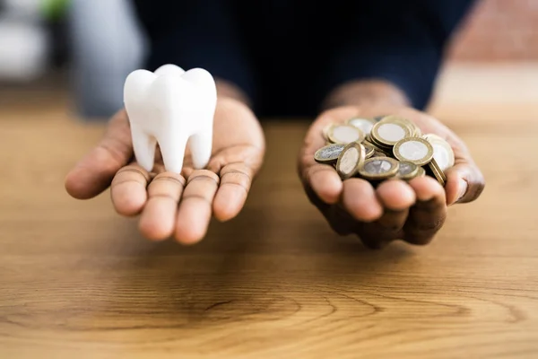 Kosten Für Zahnimplantate Zähne Versicherungsgeld — Stockfoto