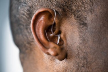 İşitme ve işitme cihazı. Engelli ve Engelli Yardımı