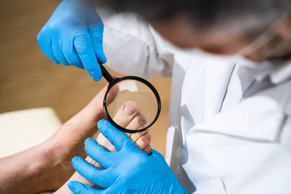 Ingrown Toenail Problem Infected Patient Foot Check — Stock Photo, Image