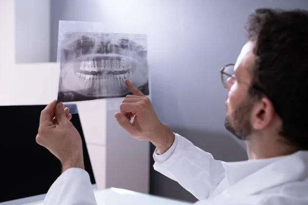 Weisheit Zähne Dental Röntgenbild Zahnschmerzen — Stockfoto