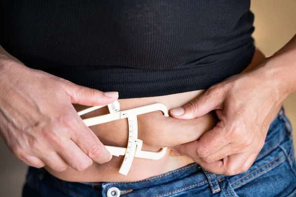 Close Mãos Femininas Medindo Barriga Gorda Com Calibrador Gordura — Fotografia de Stock