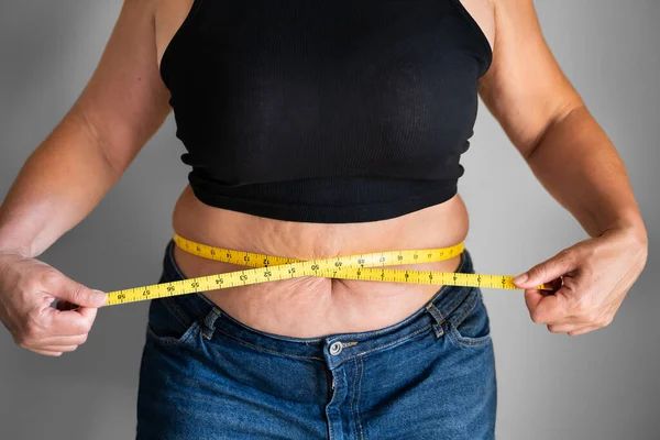 Caucasian Woman Belly Fat Using Tape Measure Closeup — Stock Photo, Image