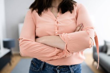 Kıyafet Deliği. Yırtılmış ve Hasarlı Kıyafetler. Parasızlık