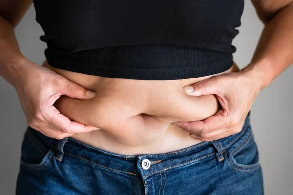 Dicke Knopfleib Und Körper Übergewichtiger Großbauch — Stockfoto