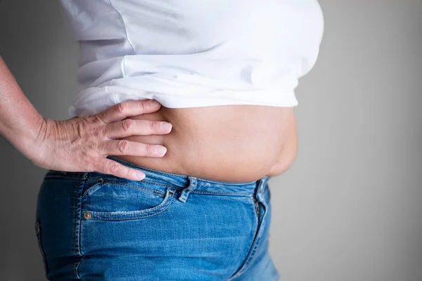 Mulher Gorda Barriga Botão Corpo Dieta — Fotografia de Stock