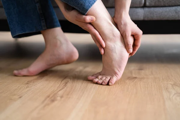 Женщина Ноги Callus Раненые Ноги Hurt Heel — стоковое фото