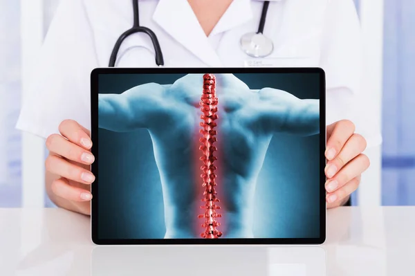 Dolor Lumbar Osteoporosis Articular Dolor Espalda Ortopédico — Foto de Stock