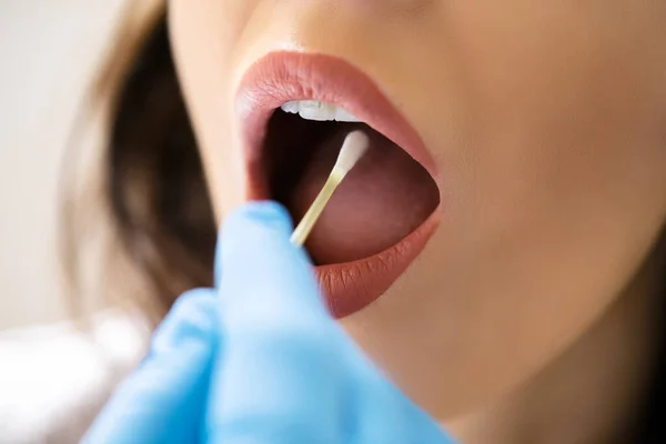 Mouth Swab Dna Test Disease Saliva Check — Stock Photo, Image