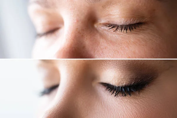 Maquillaje Piel Cara Mujer Comparando Antes Después — Foto de Stock