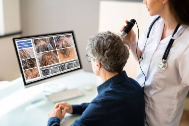 Klinikte saç derisi analizi. Saçları dökülen ve kepekli adam.
