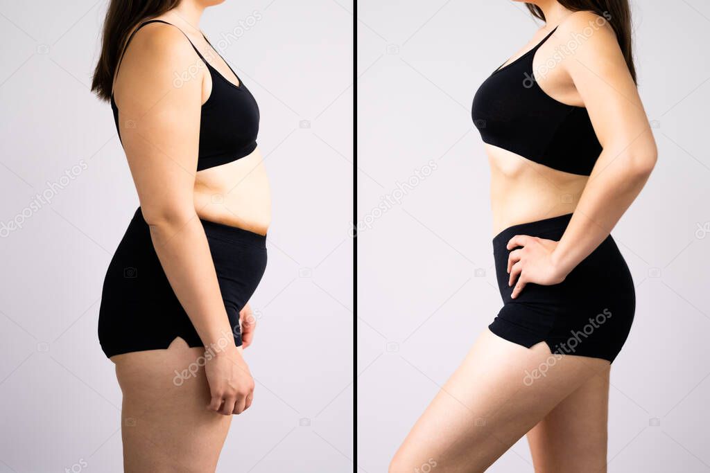 Woman Before And After Weight Loss On Gray Background. Body Shape Was Altered During Retouching