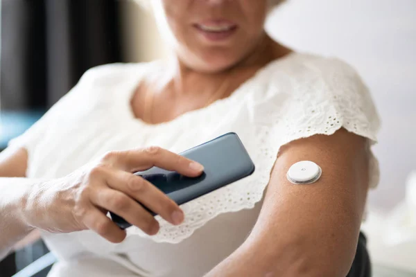 Kobieta Testowanie Poziomu Glukozy Ciągłym Monitorem Glukozy Telefonie Komórkowym — Zdjęcie stockowe