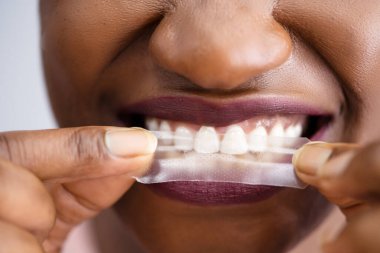 Diş beyazlatan şerit. Oral Bakım Beyazlatıcı Ürün