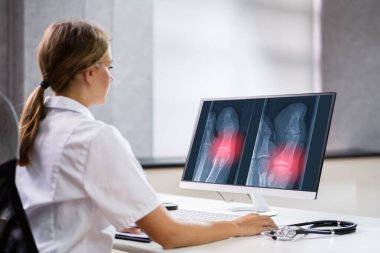 Cerrah Doktor Knee Xray Kemik Tarama Yazılım Teknolojisini Kullanıyor