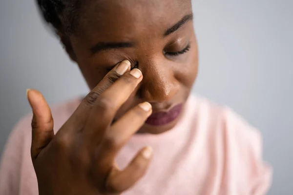 Οφθαλμικός Πόνος Και Συμπτώματα Σπασμού Κορίτσι Πρόσωπο Φαγούρα — Φωτογραφία Αρχείου