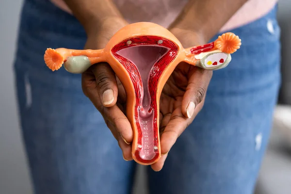 African American Woman Pregnancy Uterine Tube — Stock Photo, Image