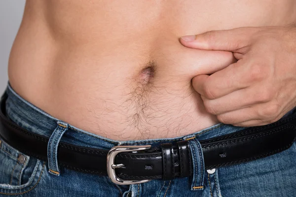 Hombre sosteniendo grasa vientre — Foto de Stock