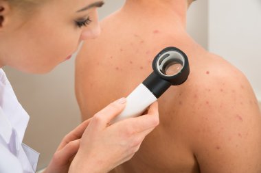 Doktor Pigmente deri incelenmesi