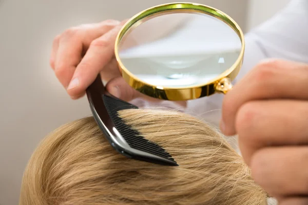 Dermatologista Olhando Cabelo Loiro — Fotografia de Stock