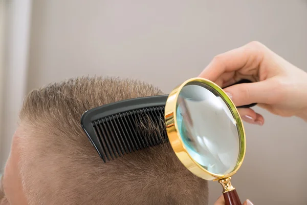 Dermatologist Looking Hair — Stock Photo, Image