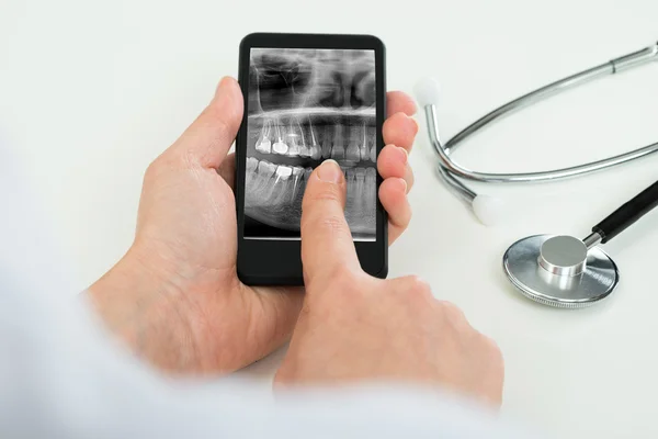 Person With Dental X-ray Film — Stock Photo, Image