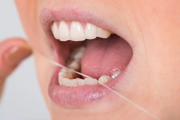 Dientes de hilo dental mujer — Foto de Stock