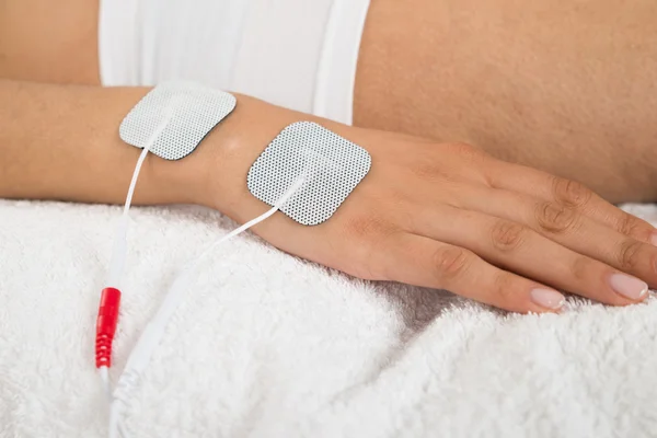 Mujer con electrodos en la mano — Foto de Stock