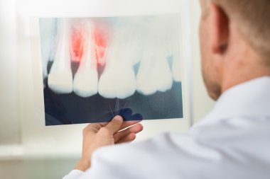 Doktor röntgene bakıyor.