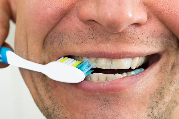 Hombre cepillarse los dientes — Foto de Stock