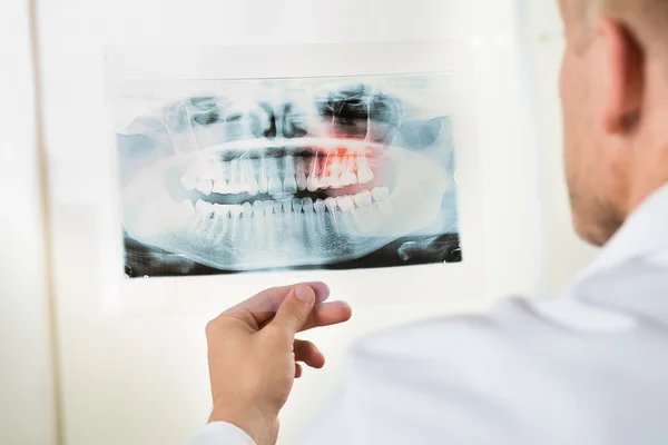 Doctor Looking At X-ray — Stock Photo, Image