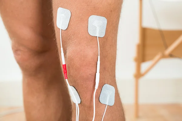 Jambe de personne avec électrodes — Photo