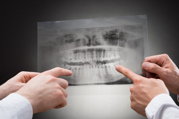 Dentists Hands Holding Dental Xray