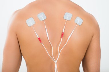 Man With Electrodes On Back clipart