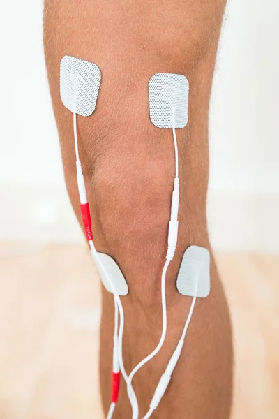 Jambe de la personne avec électrodes — Photo