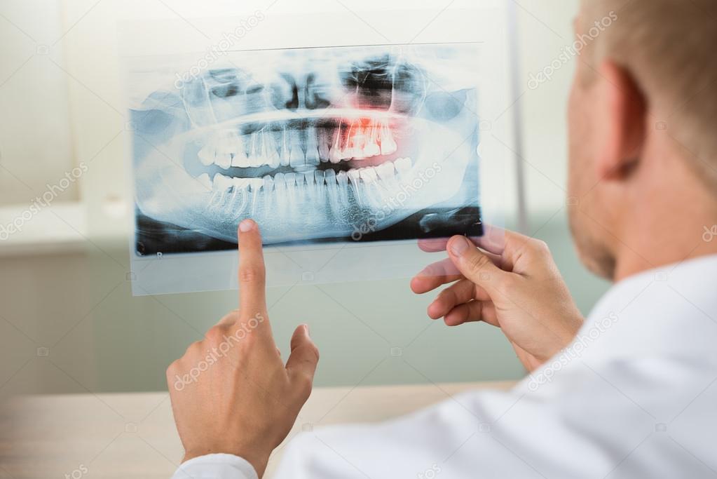 Male Doctor With X-ray