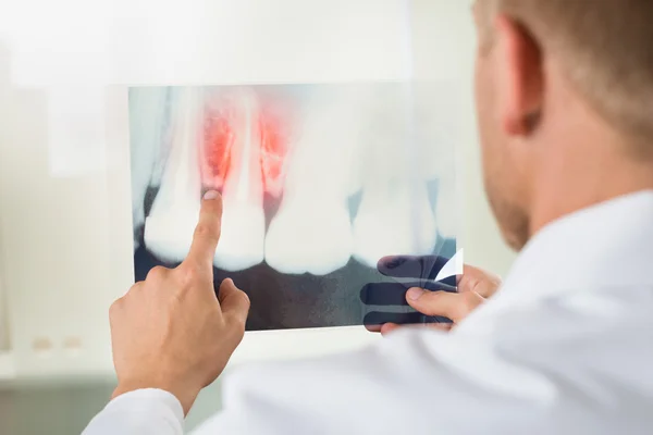 Male Doctor Pointing At X-ray — Stock Photo, Image