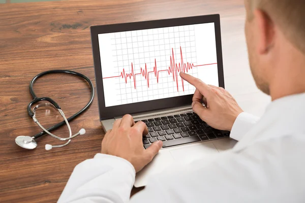 Arzt untersucht Herzschlag-Kardiogramm — Stockfoto