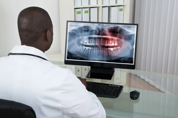 Dentista olhando para os dentes Raio-X — Fotografia de Stock