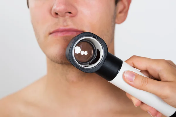 Persoon handen controleren Man gezicht met Dermatoscope — Stockfoto