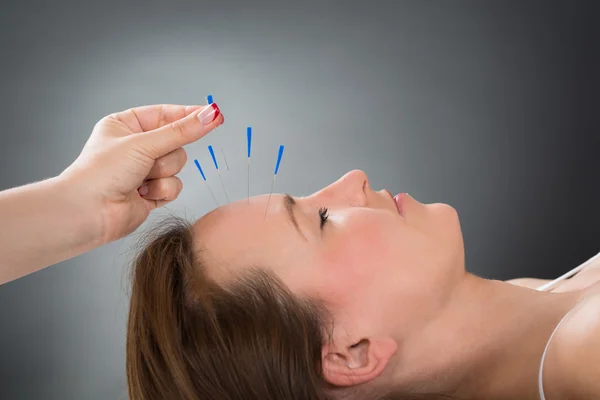 Ręce wprowadzenie igły do akupunktury na twarzy — Zdjęcie stockowe