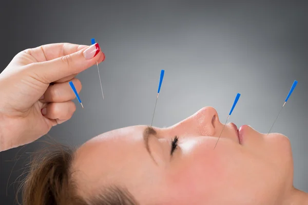 Persona poniendo agujas de acupuntura en la cara — Foto de Stock