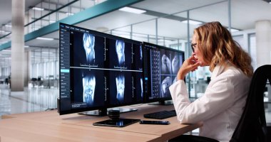 Bilgisayar Monitörü Ekranında Diz Röntgeni İnceleyen Kadın Doktor